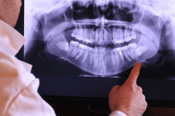 Best Tooth Infection Emergency Dentist  in Middlesex, NJ