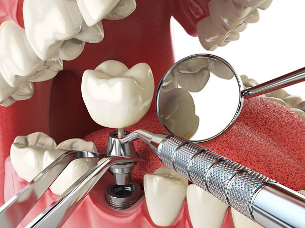 Best Emergency Gum Pain Relief  in Middlesex, NJ
